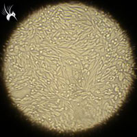 单细胞凝胶电泳步骤