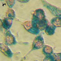 MTT试验——细节决定成败